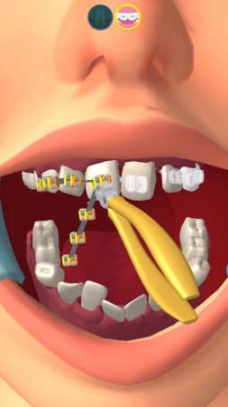 Perfect Smile 3D 1.3.2 Reklamsız Hileli Mod Apk indir